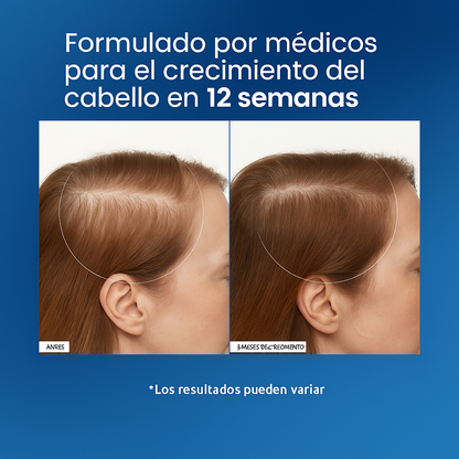 Rollo de suero para el crecimiento del cabello